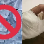 Caso estudiante: ¡No usar hielo! Doctor explica cómo proceder si cercenan algún miembro del cuerpo