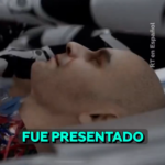 @BioComunidad presenta primer sistema para realizar trasplantes de cabeza humana utilizando cirujanos de Inteligencia Artificial (IA)