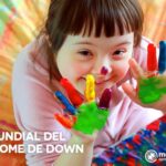 @SNSRDO: Avances médicos y sociales mejoran vida de personas con síndrome de Down