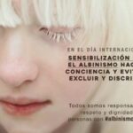 Albinos Solidarios Asociados| Conmemoran Día Internacional de Sensibilización sobre el Albinismo. UNA BELLEZA ÚNICA Y ESPACIAL